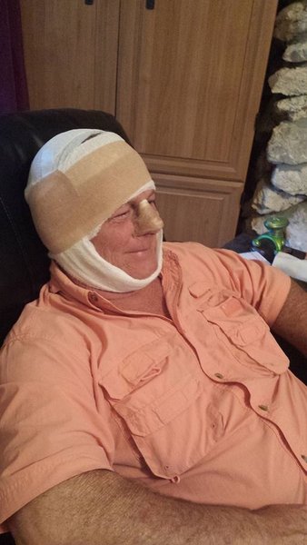 WaldonAfterSurgery.jpg (67.6 KiB) Viewed 4646 times He done some cuttin on my ear and nose!!!